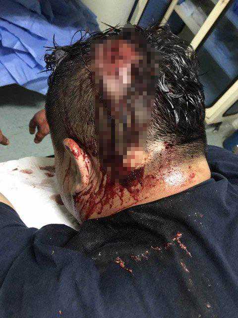 海淀四季青医院保安与患者冲突致1人头部被打伤 警方介入调查